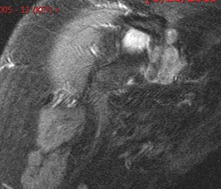 Figure 3 for case Gout ( RID3567 )